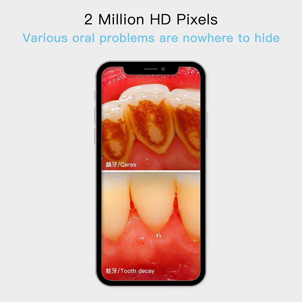 tænder kamera fuld hd oral dental cam