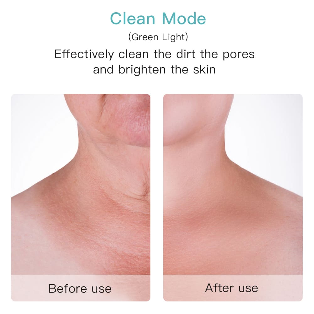 Effektiv porerenser i ansigtet eller på halsen før efter